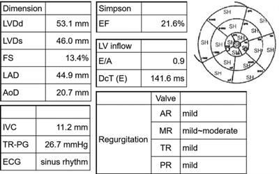 Late-onset doxorubicin-induced congestive heart failure in an elderly cancer survivor: A case report
